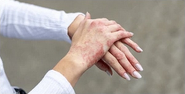 ハンドクリーム効かない人必見！手袋密封型乾燥対策【TV紹介】