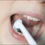 老け顔改善法！口元の筋肉をケアする電動歯ブラシ登場【TV紹介】